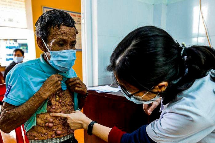 Vietnamese Photographers to Win Many Prizes at International Contests