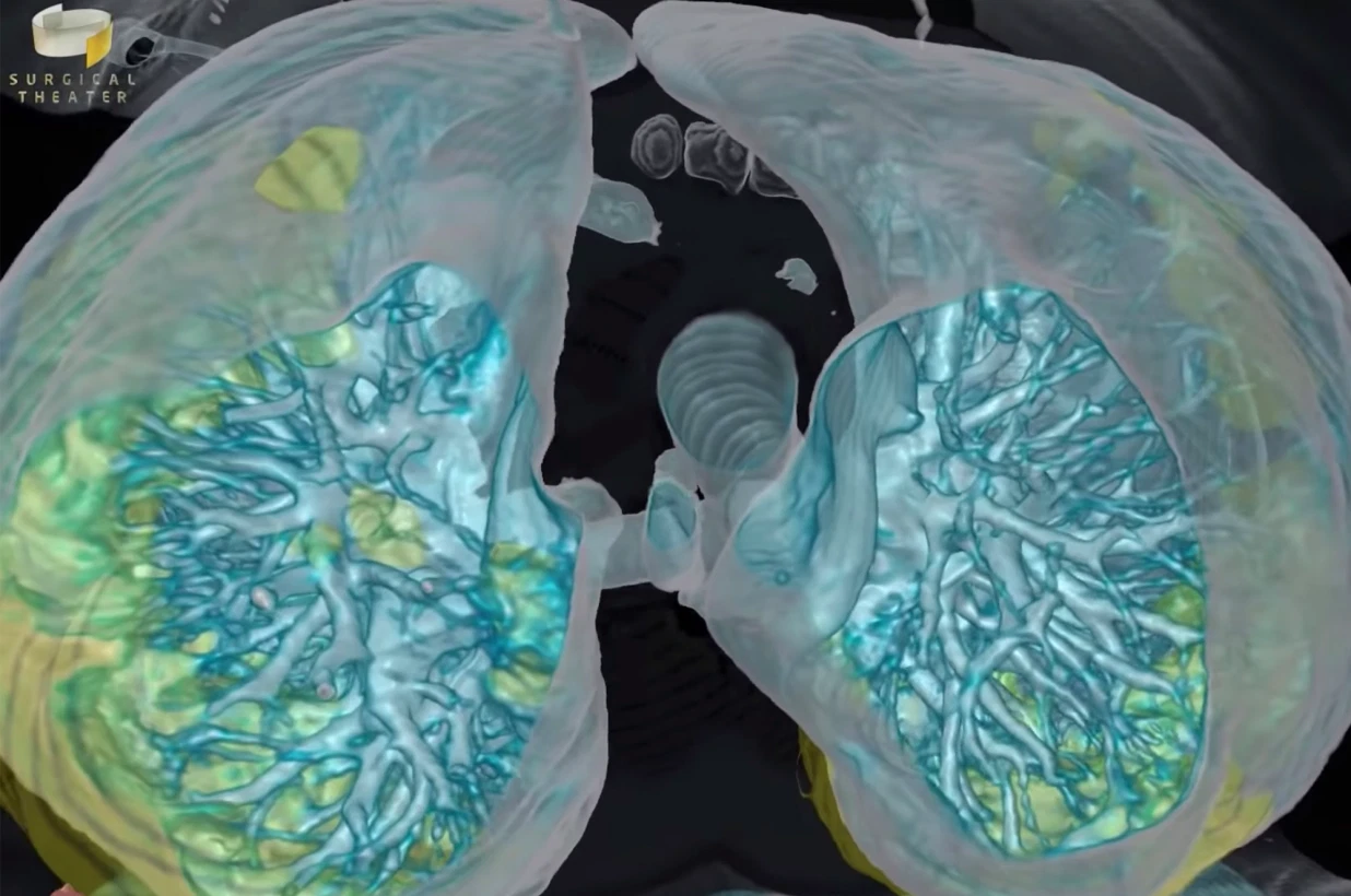 Coronavirus causes damages to the kidneys, hearts