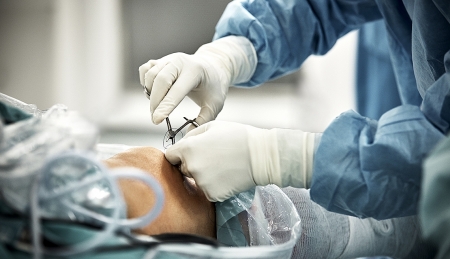 Huge hairball removed from 11 year-old’s stomach
