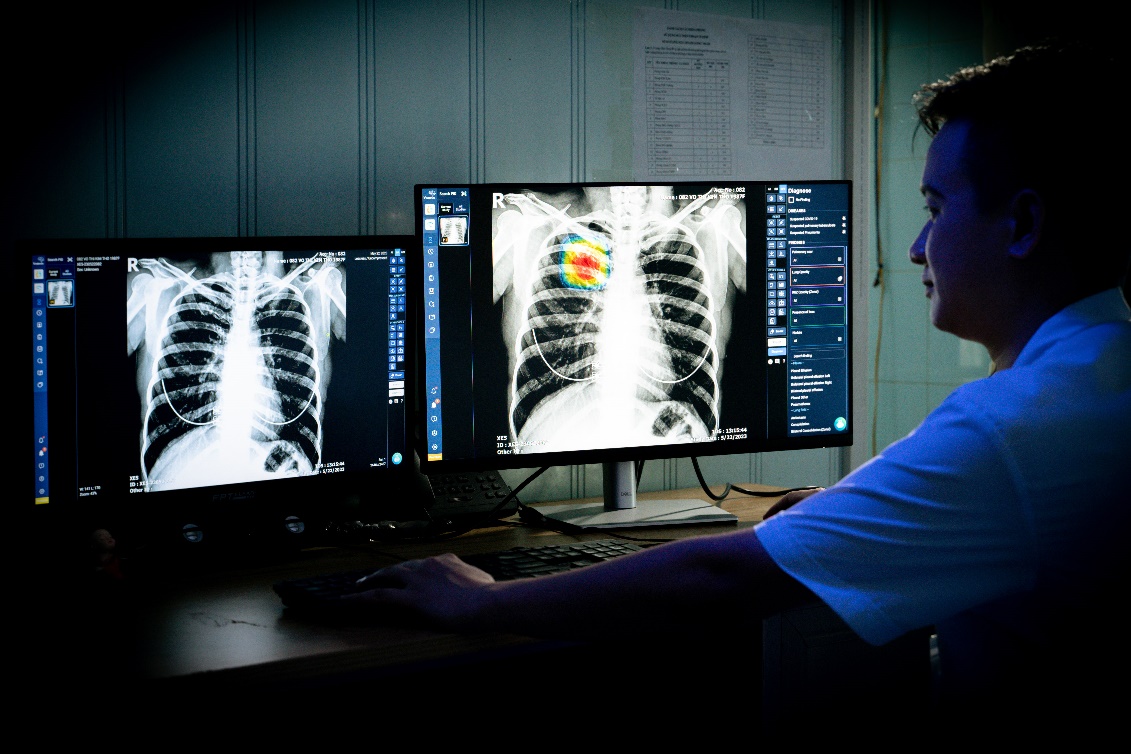 VinBrain and Global Fund continue joining forces to tackle Vietnam's tuberculosis challenge through AI in 2024