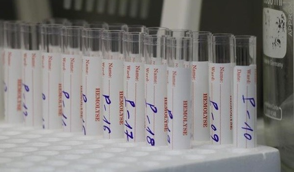 Vietnam Covid-19 Updates (July 1): 527 new cases, one million more vaccine doses received