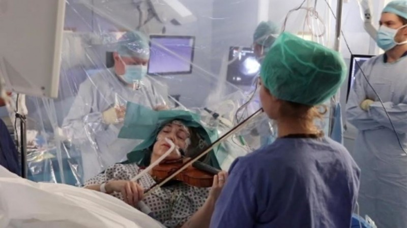woman plays violin as surgeons remove brain tumor