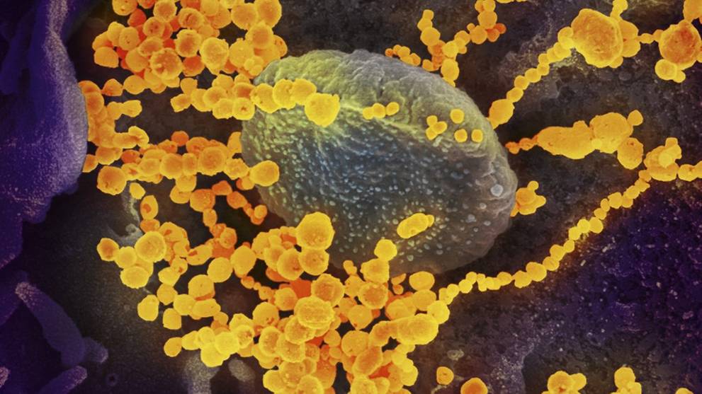 covid 19 cases are most infectious in first 7 days after developing symptoms