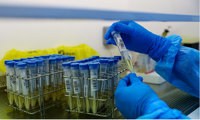 suspected indonesia covid 19 case in hcm city testing negative
