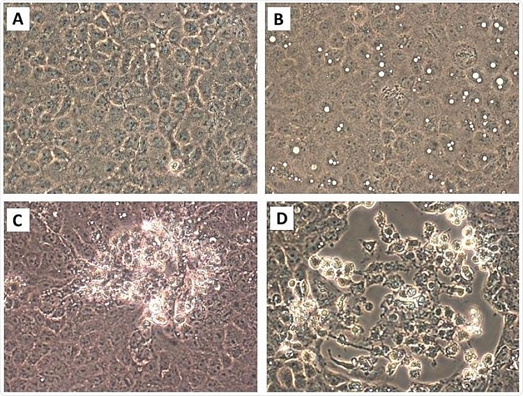 how far can air droplets can spread from person infected with coronavirus