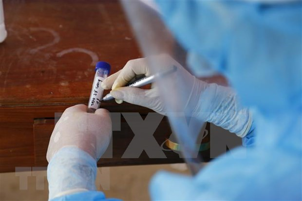 A sample for Covid-19 testing. Photo: VNA