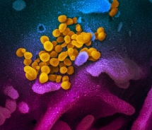 a study shows people with type a blood may be more vulne to coronavirus