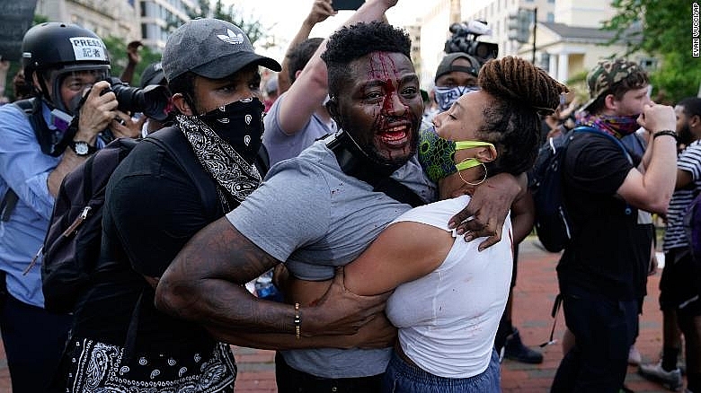 protest and riot break out around america after george floyds death photos