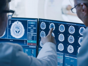 scientists fear potential wave of covid linked brain damage