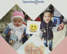 run to raise funds for children with cleft lips palates