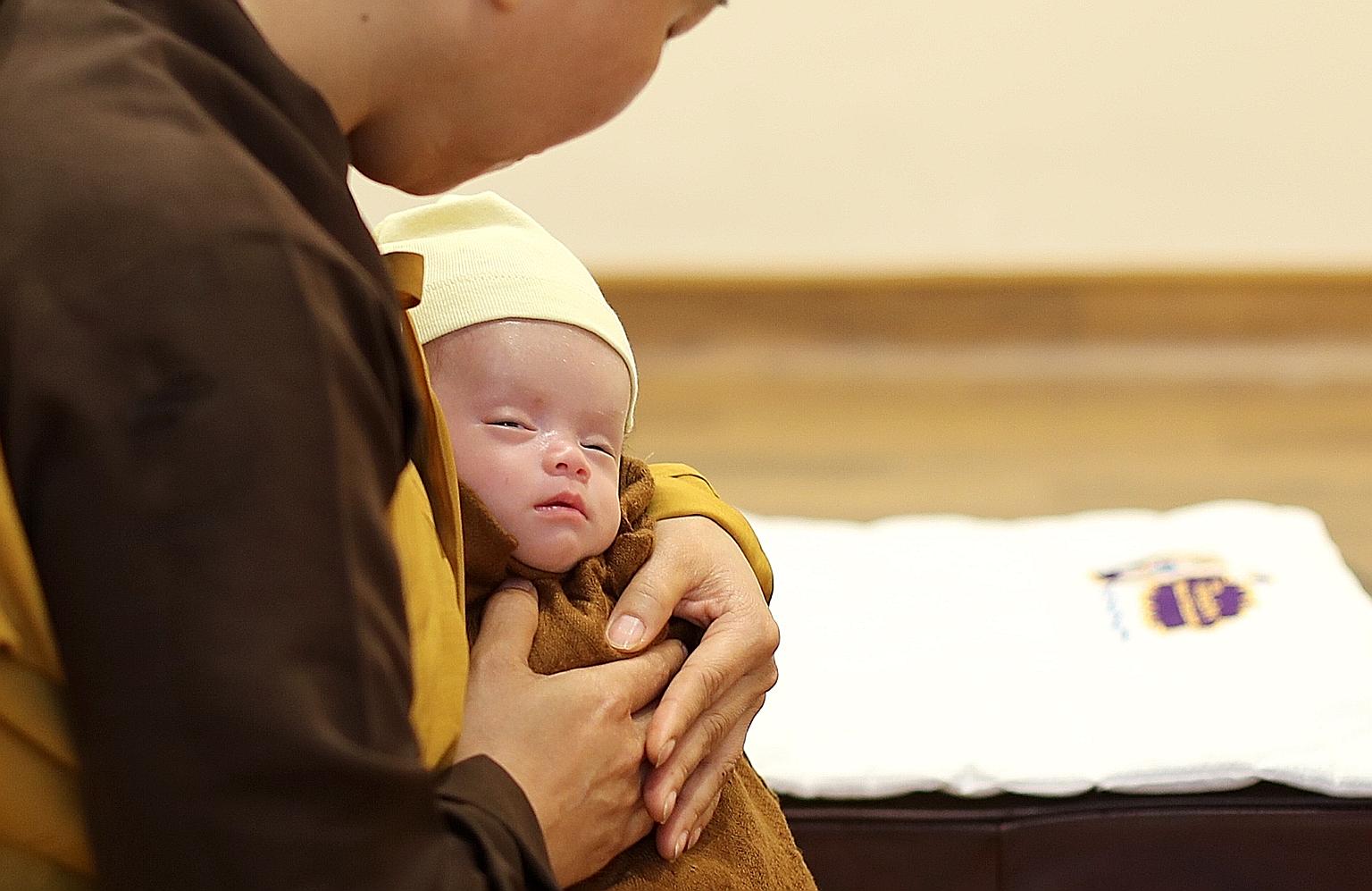 Singapore doctors offer hope to abandoned Viet infant