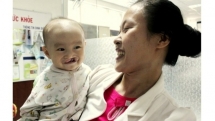 run to raise funds for children with cleft lips palates