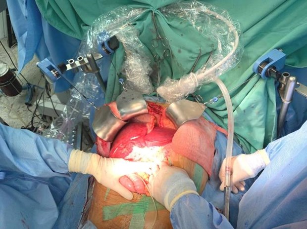 Hue Central Hospital performs record number of organ transplants in August
