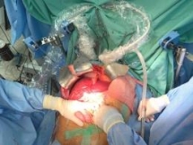 hue central hospital performs record number of organ transplants in august