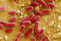 antimicrobial resistance a hard to solve quizz for vietnam