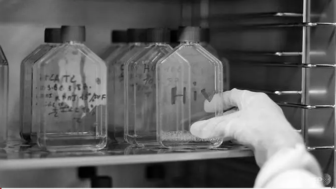Rare new HIV strain identified