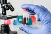 rare new hiv strain identified
